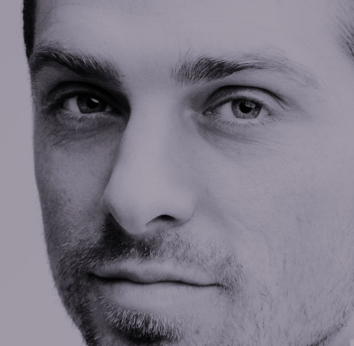 Rhinoplastie conservatrice, évolution à Paris - Dr Liwarek