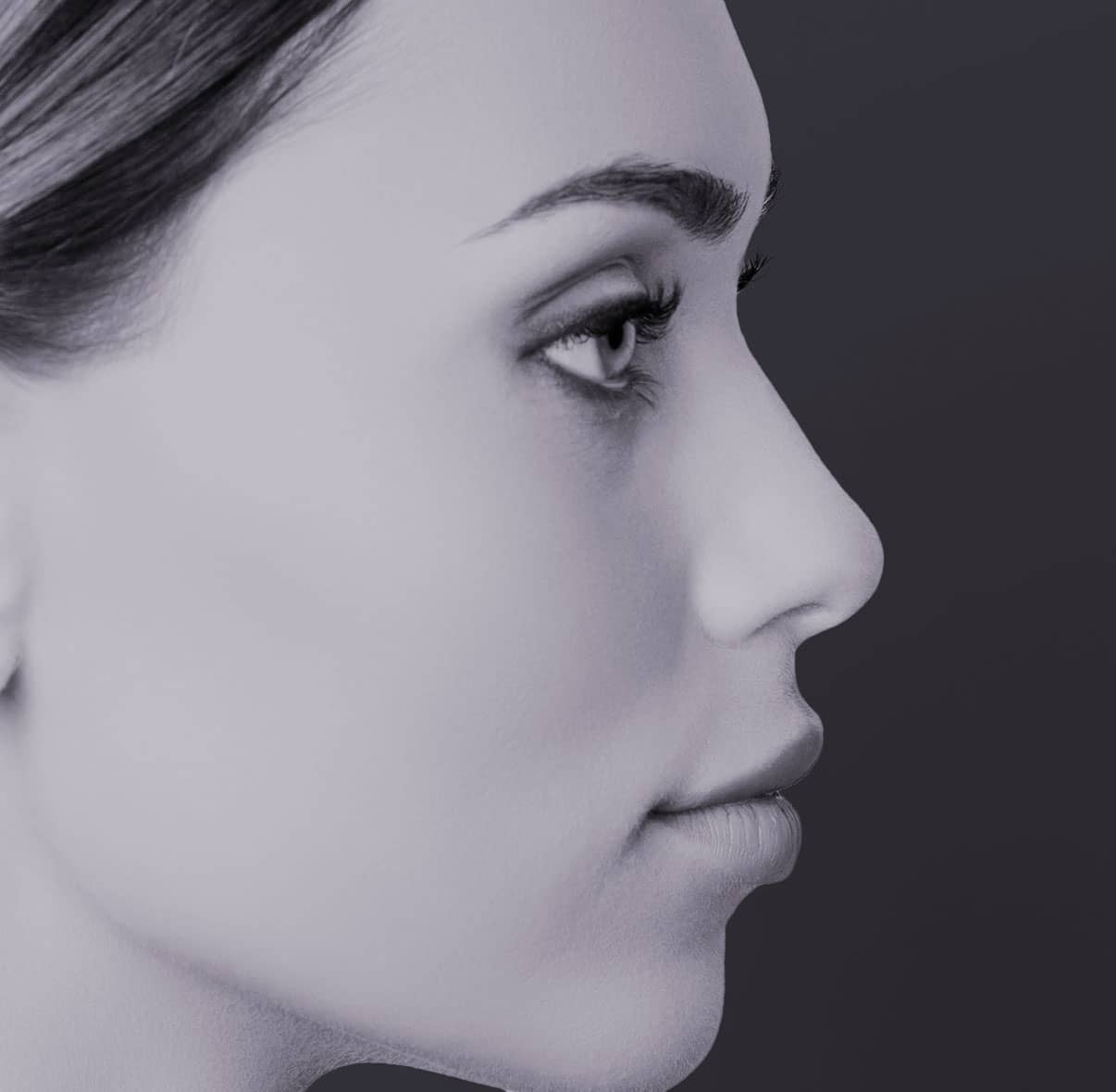Rhinoplastie primaire à Paris - Dr Liwarek